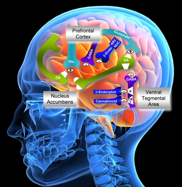 alcohol-addiction-brain-scan